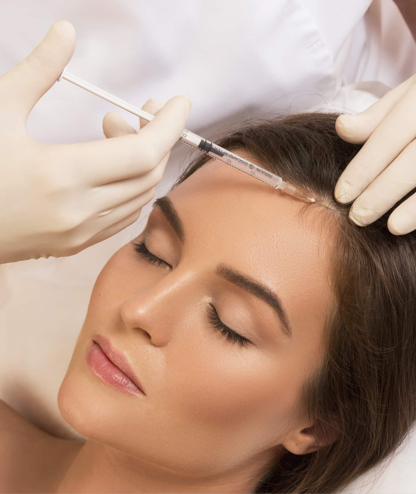 Visual representation of platelet-rich plasma (PRP) treatment near the scalp