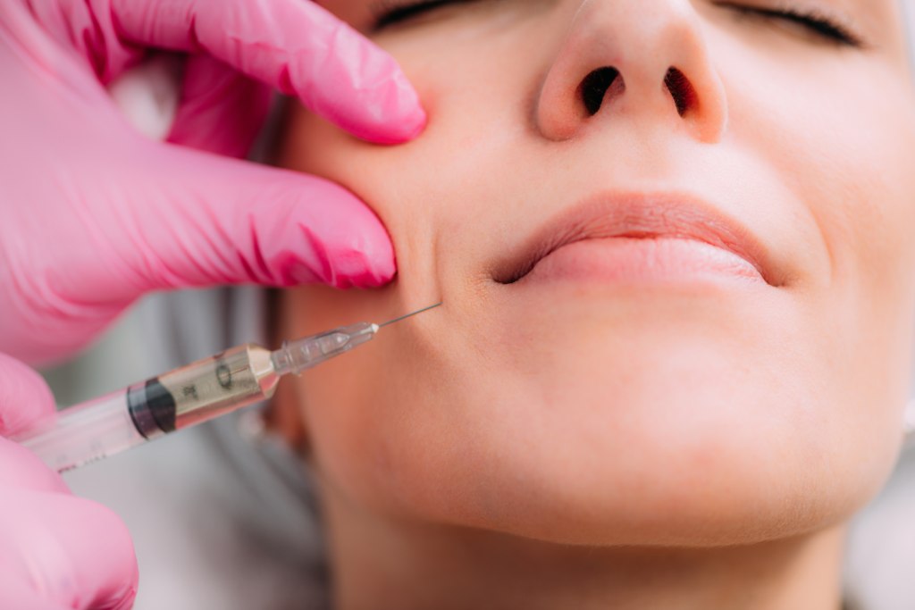 Woman receiving a dermal filler treatment to enhance facial volume and smooth wrinkles.