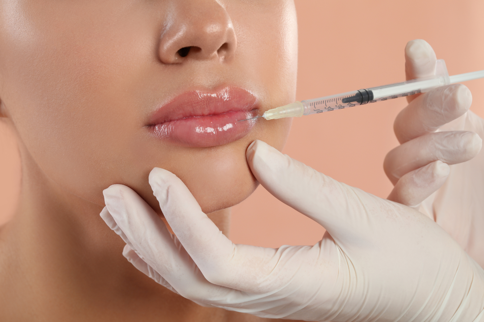 a female patient receiving lip filler