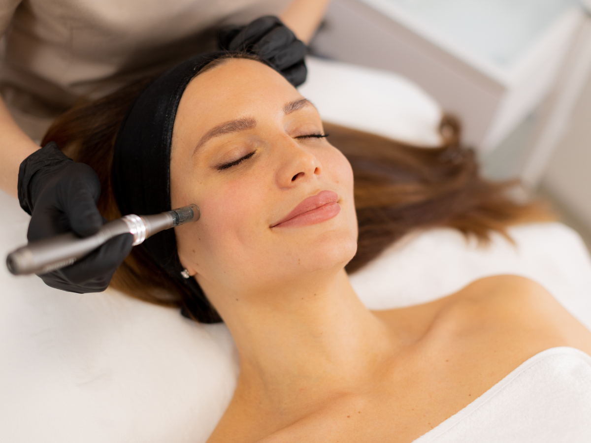 Patient receiving a microneedling treatment to support skin quality and collagen production after weight loss