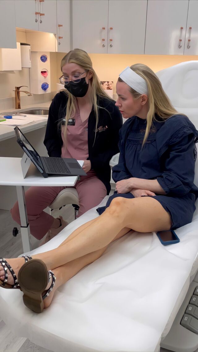 At Allure 🦋 our appointments always begin with a consultation where you’ll have time to talk to your injector 👩‍⚕️ about your goals and we’ll come up with a personalized treatment plan just for you , we are also able to start your treatment at the same appointment.