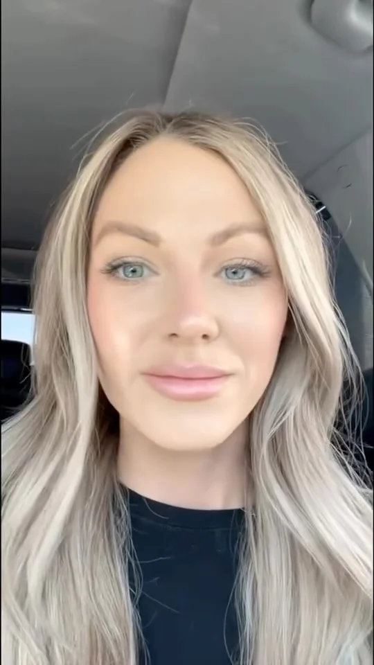 ✨ Join our beautiful client as she takes us along for her  Moxi and Broadband Light (BBL) treatments!  Watch as she shares her entire process, from start to finish, and discover how these innovative procedures can rejuvenate your skin and boost your confidence.