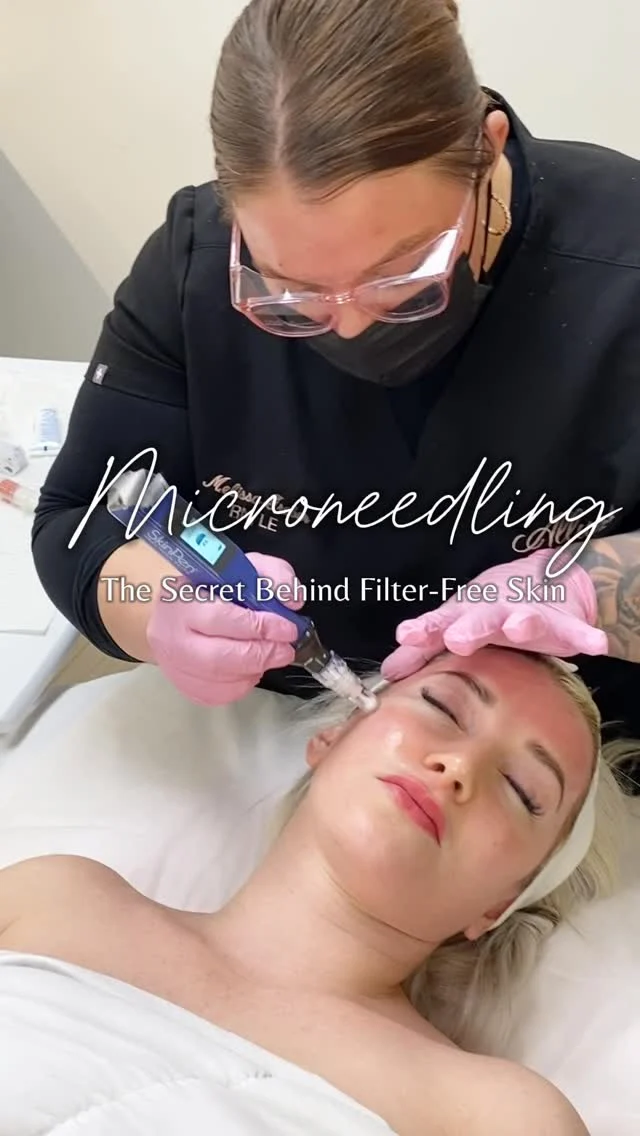 Unlock radiant skin with microneedling! 🌟 From reducing fine lines to boosting collagen, discover how this innovative treatment can transform your complexion. Ready to reveal your best skin?  #Skincare #GlowingSkin #SkinCareRoutine #HealthySkin #SkinGoals #MedicalGradeSkincare #FacialTreatment #ProfessionalSkincare #MedSpaLife #SkincareObsessed #SkinRejuvenation #SkincareGlow #SkinCareClinic #RadiantSkin #SkincareProfessional