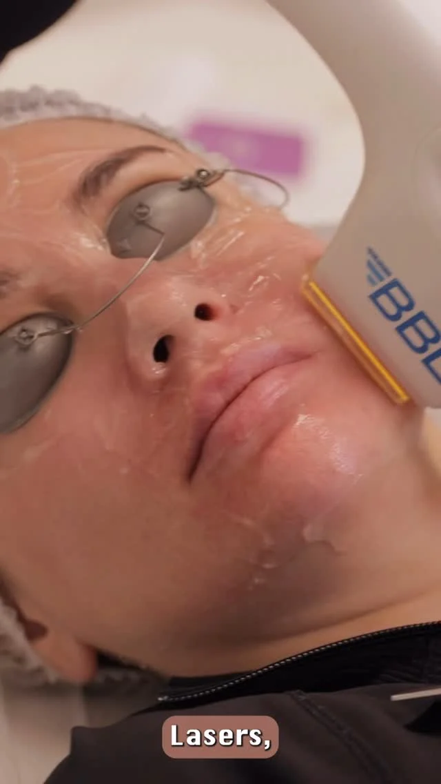 Not sure if laser, microneedling, or a chemical peel is right for you? Our expert Tanya helps break it down to help you choose the best treatment for your skin goals. 💞✨
