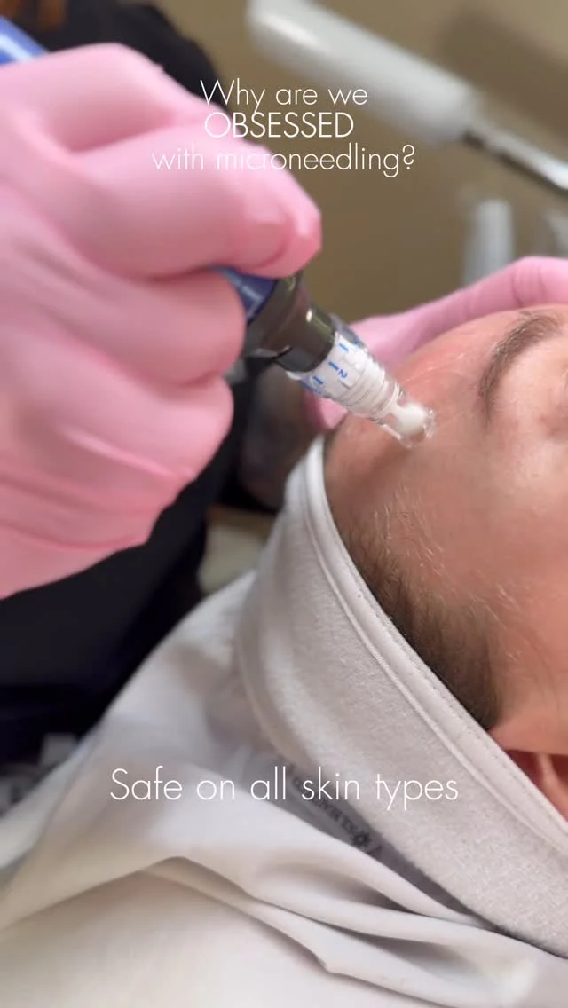Why are we obsessed with microneedling? Because the results speak for themselves.✨🙌

We’re using SkinPen, the gold standard in microneedling—FDA-cleared, clinically proven, and safe for all skin types.
From improving skin texture and tone to minimizing pores, acne scars, and fine lines—this treatment does it all.

Ready for your glow-up?
Drop your questions below or DM us to book!