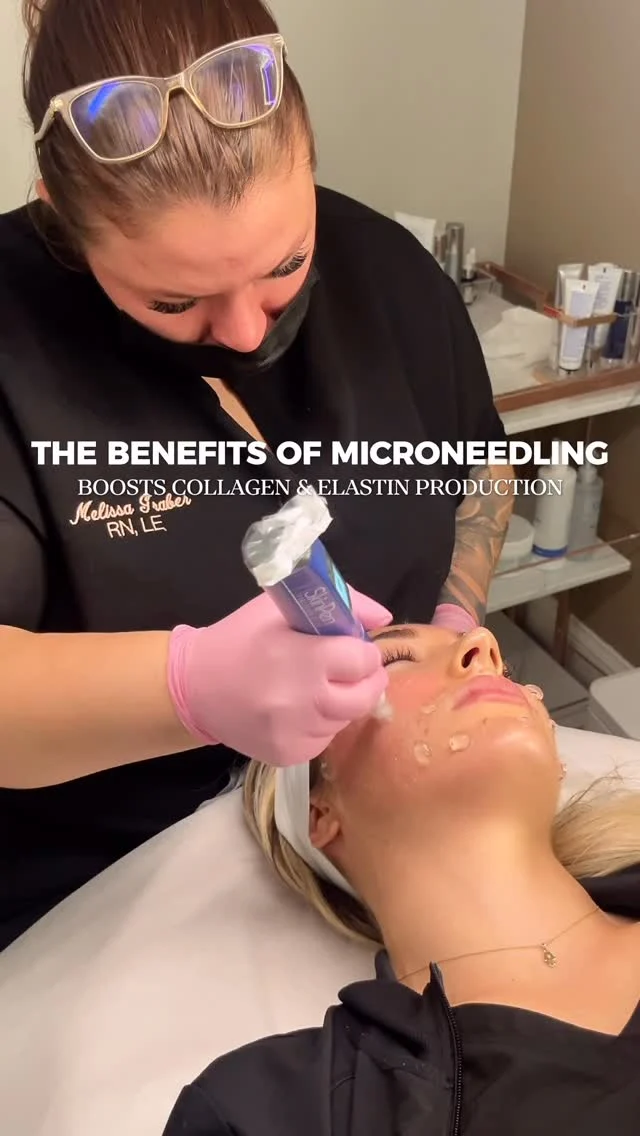 ✨ SkinPen® Microneedling: Transform Your Skin From Within ✨

Microneedling with the FDA-cleared SkinPen® device is one of the most effective ways to stimulate your skin’s natural healing process. By creating controlled micro-channels in the skin, SkinPen encourages your body to produce new collagen and elastin—the building blocks of smoother, firmer, healthier skin.

💎 Why patients love SkinPen®:
• Safe for all skin types + tones
• Minimal downtime (most patients are back to normal within 24 hours)
• Natural, long-lasting results that improve over time
• Clinically proven + backed by science

Your skin deserves to glow—not just on the surface, but from the inside out. ✨

Click the link in our bio to book now 

#fullfacerefresher #medspa #medicalspa #skincare #skin #glowingskin #beauty #antiaging #aesthetics #facial #facials #esthetician #skincareroutine #healthyskin #botox #dysport #injectables #fillers #smilelines #lipfiller #lipfillers #cheekfillers #dermalfillers #microneedling #hydrafacial #laserhairremoval #dermatology #selfcare #laser #tg