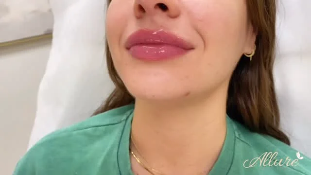 💉✨ Freshly injected, straight off the syringe ✨💉

Full, balanced, and naturally enhanced the Allure way. Our goal is always to deliver lips that elevate your natural beauty while maintaining a soft, seamless finish.

Your results should look as good fresh out of the chair as they do once settled. That’s the Allure Aesthetics difference. 💎

📩 DM us to book your lip appointment today.

#LipFiller#LipInjections#LipGoals#PerfectPout#LipsOnFleek#NaturalLips#JuicyLips#LipFillerBeforeAndAfter#KissableLips#FillerQueen#LipEnhancement#AestheticInjector#LipFillerResults#LipFillerTransformation#BeautyEnhancement#FillerExperts#MedSpaLife#NonSurgicalEnhancement#FacialBalancing#LipFillerSpecialist#ConfidenceInjections#DermalFiller#InjectorLife#BeforeAndAfterLips