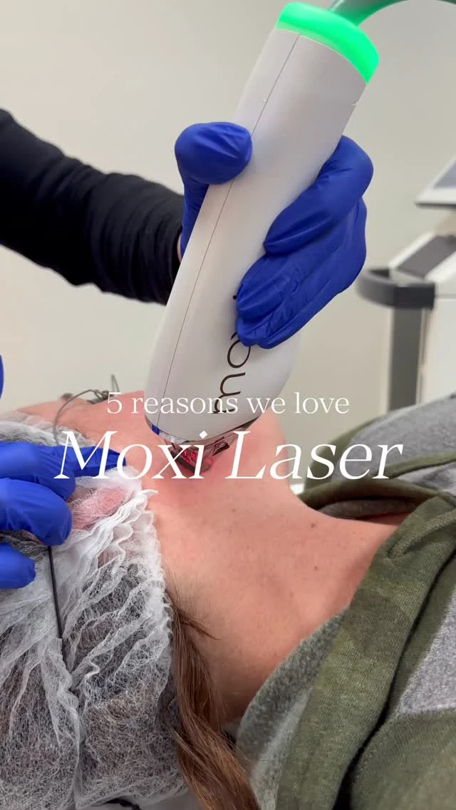 ☁️✨ Laser season is officially here — and Moxi is the ultimate treatment to hit reset on your skin before the holidays. ✨☁️

Fall is the perfect time to treat sun damage, uneven texture, and pigmentation from summer  and Moxi works to gently resurface your skin, revealing a brighter, smoother, more youthful glow with minimal downtime.

Whether you’re prepping for holiday photos or just want that flawless, makeup-optional skin  now’s the time to start your Moxi journey.

📅 Book your fall glow-up now and thank yourself later.