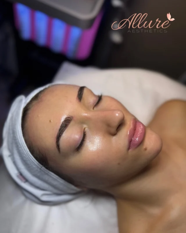 ✨ The HydraFacial Glow is REAL ✨

When your skin is this hydrated, smooth, and radiant - you feel the difference instantly. HydraFacial deeply cleanses, exfoliates, extracts, and infuses antioxidants + hyaluronic acid for that signature glass-skin glow 🌊

This beauty’s skin is beaming with hydration and clarity - swipe over to see her before, and you’ll understand why our patients are obsessed with these results.

If you’ve been struggling with dullness, congestion, or uneven tone, this treatment is a complete reset for your skin barrier and hydration levels. It’s gentle enough for sensitive skin yet powerful enough to deliver instant, noticeable results.

💧 Brightened complexion
💧 Smaller pores
💧 Softer, smoother texture
💧 Makeup-optional glow

Ready to experience your HydraFacial glow? Book your appointment now and let your skin drink up the glow it’s been missing.