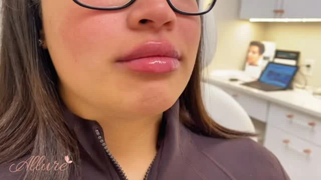 The art of subtle enhancement✨ beautifully sculpted, plump lips that enhance your natural beauty 💋