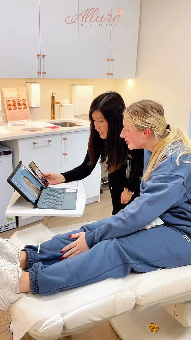 This beauty has been an Allure client for years, maintaining her lip enhancement with strategic touch-ups to preserve shape, symmetry, and structure.

Results like this aren’t accidental — they’re maintained.

At Allure Aesthetics LLC, precision and longevity matter.