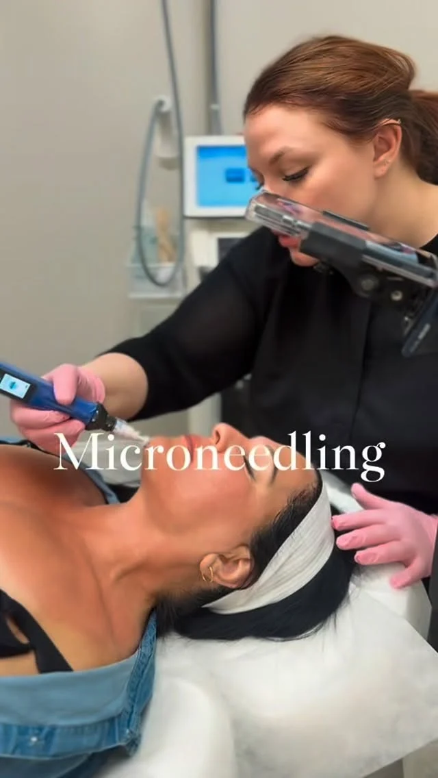 ✨ The glow starts beneath the surface.

SkinPen® microneedling is one of our favorite treatments for the face, neck, and chest - because beautiful skin isn’t just about makeup… it’s about collagen.

By creating controlled micro-channels in the skin, this treatment helps support your body’s natural collagen and elastin production, improving:

▫️ Texture
▫️ Fine lines
▫️ Acne scars
▫️ Crepey skin
▫️ Overall tone + radiance

Your face doesn’t stop at your jawline - and neither should your skincare.

If you’re ready for smoother, firmer, more luminous skin from face to décolleté… this is your sign. ✨

Results build over time. Consult required.