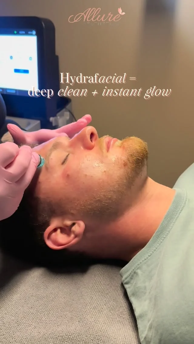 Hydrafacial is not a facial, it’s a controlled skin reset.

This treatment was performed to deeply clear congestion, remove buildup within the pores, and restore overall skin function without disrupting the skin barrier.

What you’re seeing in this video is one of the most important steps, painless, vacuum-assisted extractions. Instead of manual pressure that can irritate the skin, this technology gently lifts out debris, oil, and impurities while simultaneously infusing hydration back into the skin.

This allows us to treat congestion more efficiently, reduce the risk of inflammation, and support smoother texture and more refined pores without downtime.

Every step is intentional, from exfoliation to extraction to infusion, all designed to improve skin clarity and maintain dermal integrity.

If your skin feels congested, uneven, or not responding to at-home care, this is where we start.

Book your Hydrafacial through the link in bio.

#hydrafacial #medicalfacial #skinhealth #allureaesthetics #clearskin