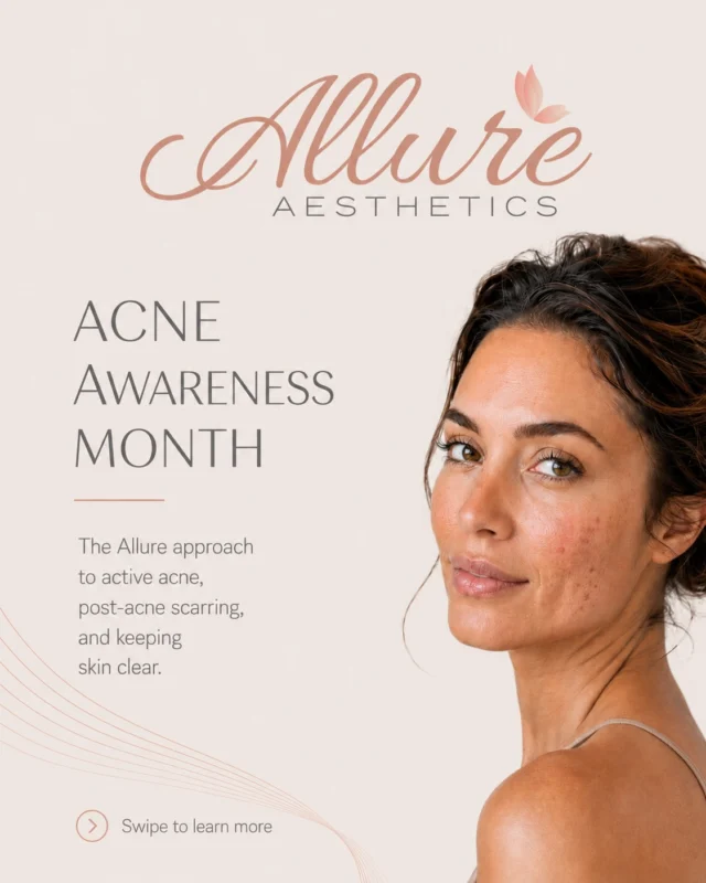 Acne Awareness Month 🤍

Acne is one of the most common skin concerns we treat, but every client’s skin story is different, which means every plan should be, too.

At Allure, we love combining customized ZO® Skin Health regimens with thoughtful in-office treatment plans to support clearer, healthier, more balanced skin over time. Homecare helps create the foundation, while in-office treatments can help target concerns like congestion, inflammation, post-acne redness, texture, and acne scarring.

Our approach is never about choosing a random facial or product, it’s about understanding your skin, your triggers, your lifestyle, and your goals so we can guide you toward the most effective plan.

Clear skin takes consistency, patience, and the right strategy and we’re here to help you feel supported every step of the way. ✨

#AcneAwarenessMonth #AllureAesthetics #ZOSkinHealth #AcneTreatment #SkinHealth MedicalGradeSkincare
