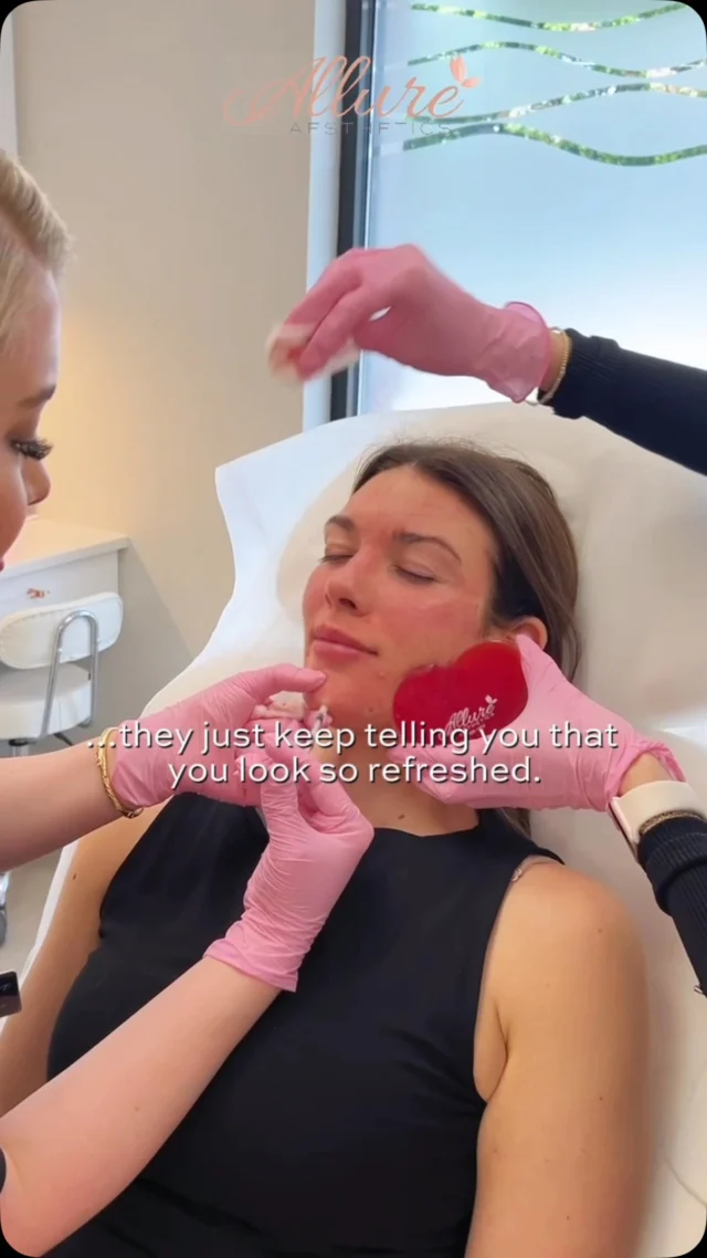 One of the most common misconceptions about neuromodulators is that the goal is to eliminate movement. In reality, a thoughtful treatment plan is designed to soften the appearance of dynamic lines while preserving natural facial expression and balance.

By temporarily relaxing targeted muscles, Dysport can help minimize the appearance of forehead lines, frown lines, and crow’s feet, creating a smoother, more rested appearance without changing what makes you look like you.✨

The best results are often the ones no one can quite pinpoint.💓

They’re simply noticing that you look well-rested, confident, and refreshed.

Interested in learning if Dysport is right for you? Schedule your consultation with one of our experienced providers and receive a customized treatment plan based on your individual goals.💞

Results vary per individual.

#AllureAesthetics #Dysport #Neuromodulators #FacialBalance #AestheticMedicine