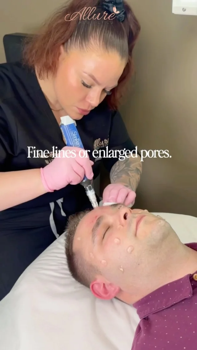 Healthy skin starts beneath the surface.

SkinPen® microneedling works by creating controlled microchannels in the skin, stimulating your body’s natural collagen and elastin production to improve texture, soften the appearance of acne scars, minimize the look of pores, and address early signs of aging.

The result isn’t skin that looks “done”, it’s skin that looks healthier, smoother, and more refined over time.

Whether you’re looking to improve skin quality, support long-term collagen production, or elevate your skincare results, SkinPen is a treatment that works with your skin, not against it.

Ready to find out if SkinPen is right for you? Schedule your consultation with one of our providers today.

Results vary by individual. A personalized treatment plan will be recommended during your consultation.